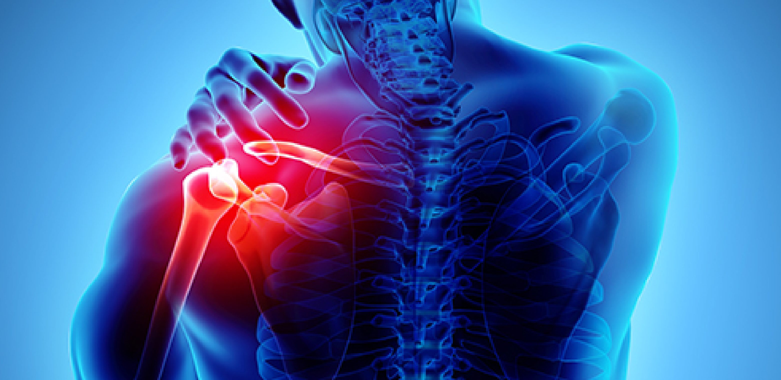 Managing Arthritis Pain: How Effective Are Naproxen Tablets?